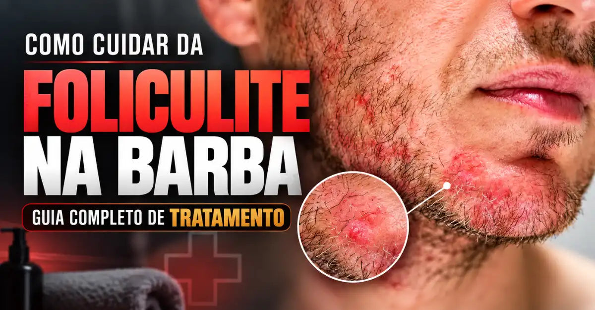 Foliculite na barba