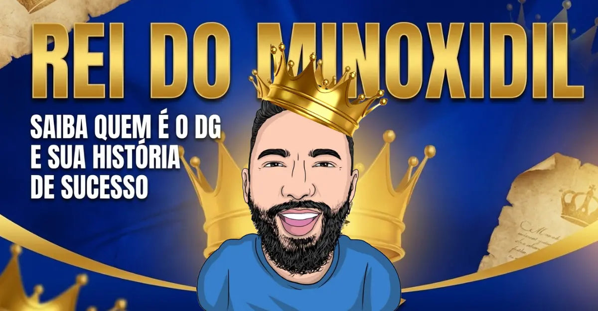 Rei do Minoxidil: Saiba quem é o DG e sua História de Sucesso