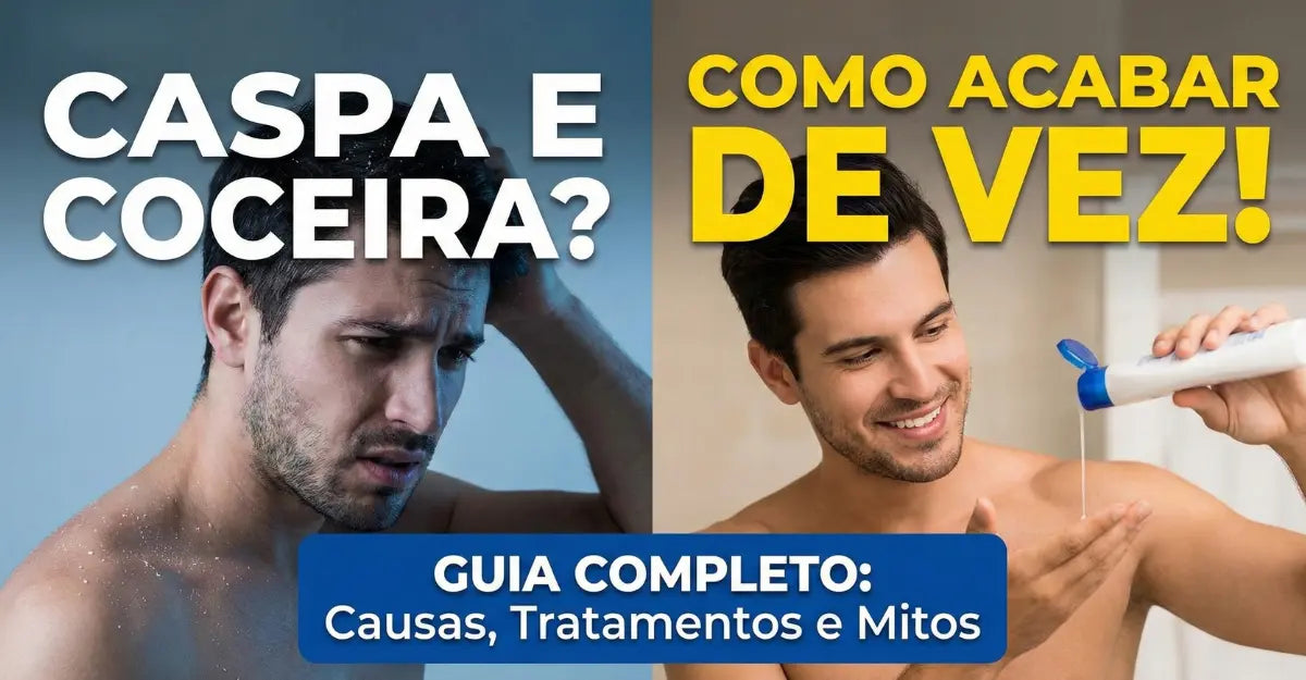 Como Acabar com a Caspa: Causas, Tratamentos e Mitos (Guia 2026)