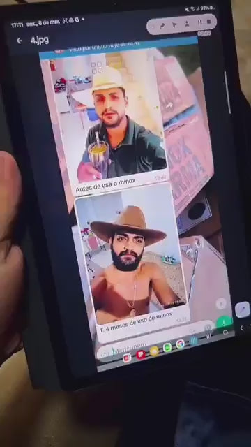 Vídeo: Evolução real de clientes MinoxFarma com minoxidil e envios diários de pedidos